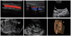 Ecógrafo Veterinario Doppler Color <span class=keywords><strong>4D</strong></span> Sonoscape S2V, Equipo de Ultrasonido Veterinario, Escáner de Ultrasonido Portátil Veterinario - Product Image 6
