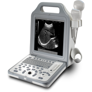 Máquina de ultrasonido Digital para <span class=keywords><strong>embarazo</strong></span>, MSLPU50, portátil, precio barato - Product Image 3