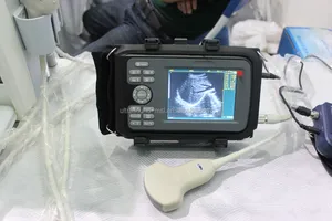 Draagbare Handheld Dierenarts Ultrasound Machine MSLVU04 Voor Runderen Schapen Geit Equine