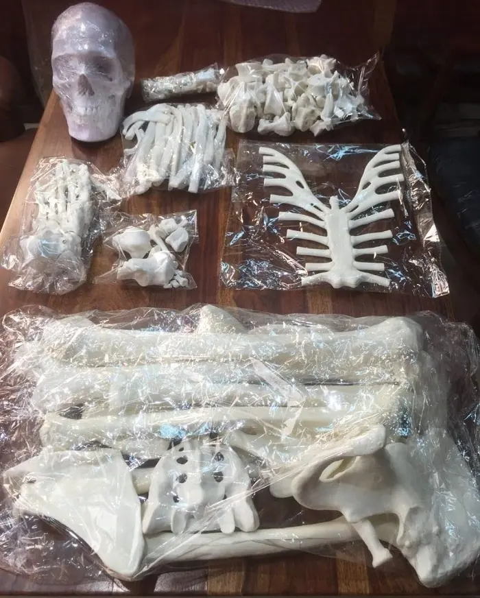 Manufacturer Disarticulated Human Skeleton with around 200 Bones