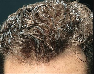 Sistema Capilar <span class=keywords><strong>de</strong></span> Silicona Vloop <span class=keywords><strong>para</strong></span> Hombre, Peluca <span class=keywords><strong>de</strong></span> Cabello Humano Real, Fabricada en China, Mejor Línea <span class=keywords><strong>de</strong></span> Cabello Natural - Product Image 1