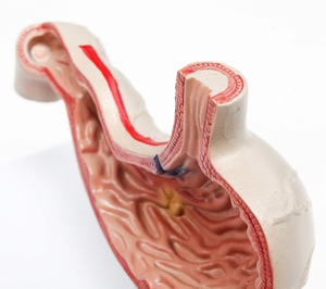 Gelsonlab HSBM-272 qualité Avancée Malades <span class=keywords><strong>L</strong></span>'<span class=keywords><strong>estomac</strong></span> modèle d'<span class=keywords><strong>estomac</strong></span> Médical modèle - Product Image 5