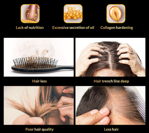 Solución para el cuidado del cabello, espray para el crecimiento del cabello, 100% Natural, a base de hierbas, reparador OEM, solución anticaída de pelo - Product Image 5