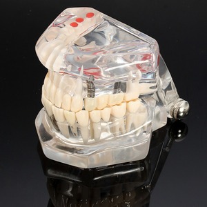 Modelo de dientes <span class=keywords><strong>para</strong></span> enseñanza Dental y entrenamiento - Product Image 1