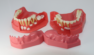 Mezcla de dentición pediátrica desarrollo dental modelo edad 3-6 - Product Image 5