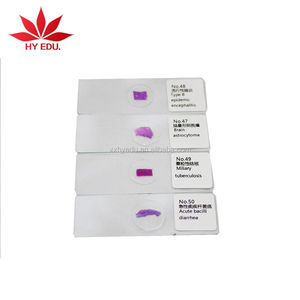 Individuelle Objektträger zur Auswahl aus dem Set Humanen Histologie-Gewebeobjektträger, Histologie-Gewebeobjektträger - Product Image 1