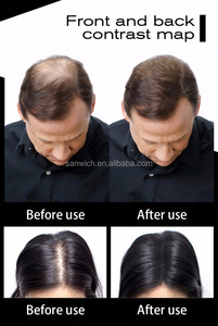 Fibre di cheratina per infoltimento dei <span class=keywords><strong>capelli</strong></span> 25G, per uomo e <span class=keywords><strong>donna</strong></span> - Product Image 6