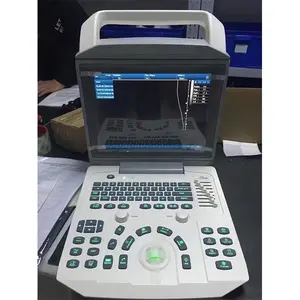 Factory Price Laptop Black And White Ultrasound Machine