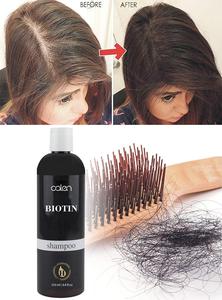 Shampoo à la biotine en marque propre pour la croissance des cheveux, formule épaississante entièrement naturelle avec effets antipelliculaires et rafraîchissants pour hommes et femmes - Product Image 5
