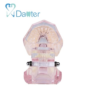 Modello Anatomico Dentale Ortodontico in Resina Plastica per Comunicazione Professionale con Pazienti - Product Image 5