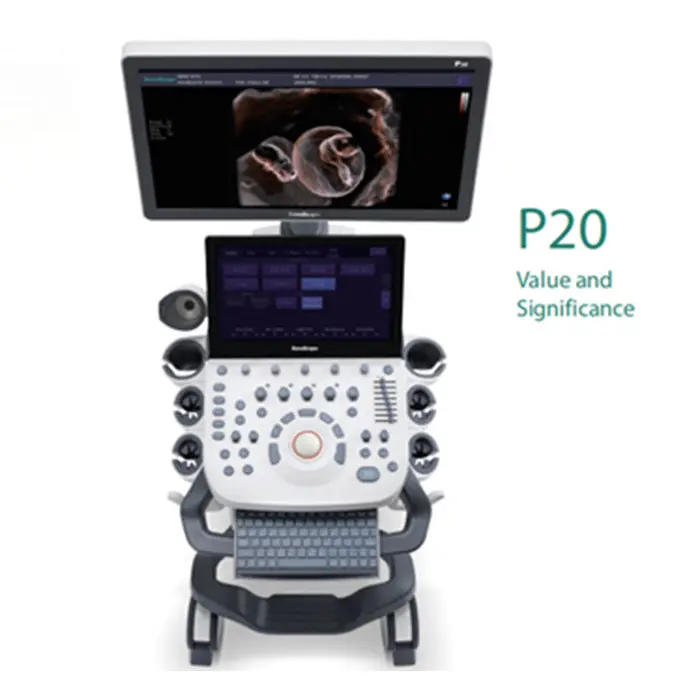 Nuovo Sonoscape P50 P20 colore doppler ad ultrasuoni macchina con la tecnologia diagnostica 4D