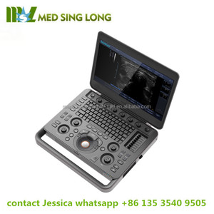 USG Sonoscape X5 DI dubai/hewan ultrasound doppler warna untuk rumah sakit - Product Image 5