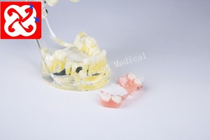 Mezcla de dentición modelo dental con los dientes permanentes y desdentado dientes de bebé y de retención - Product Image 2
