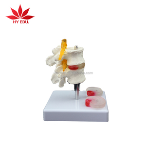 Giảng dạy Y Tế 2 Mô Hình Bộ Xương đốt sống thắt lưng với thoát vị và đĩa đệm intervertebral - Product Image 4