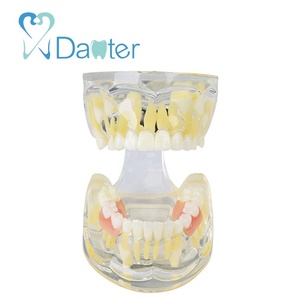 Modèle de dentisterie mixte, pour lumineux de dents manquantes, tétines primaire 1ère et 2ème génération, avec flipper, offre spéciale - Product Image 1