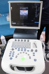 Máquina/scanner de ultrassom Doppler 3D 4D carrinho digital completo