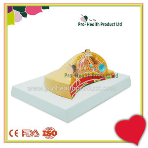 Modelo Anatômico de Doença de Lesão em Patologia Mamária - Product Image 5
