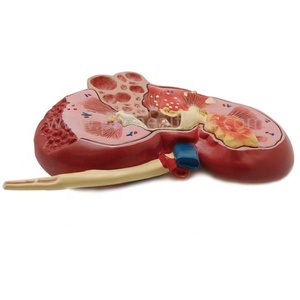 Modelo de Anatomía de riñón de enfermedad educativa médica de humano - Product Image 3