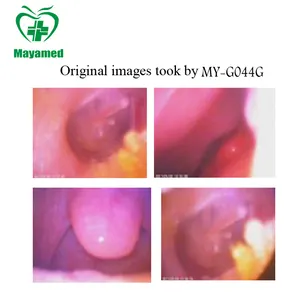 Yüksek kaliteli profesyonel el dijital tıbbi kapsam serisi MY-G044G taşınabilir yenilikçi otoskop fiyat