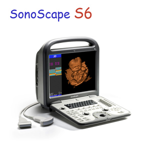 Appareil d'échographie Doppler couleur portable 3D 4D <span class=keywords><strong>Sonoscape</strong></span> <span class=keywords><strong>S6</strong></span> / Appareil d'échographie <span class=keywords><strong>Sonoscape</strong></span> de haute qualité - Product Image 2