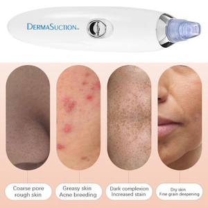 <span class=keywords><strong>Dropshipping</strong></span> Comedone Aspirapolvere di Aspirazione Della Cheratina di Rimozione Della Cicatrice Acne Poro Peeling Viso Pulizia Del Viso Cura Della Pelle Macchina di Bellezza - Product Image 2