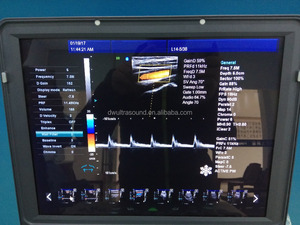 Hotsale bas prix vétérinaire d'ultrason de doppler de couleur