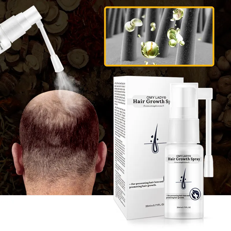 30 days hair care efficient restore growth oil treatment men and women hair loss products treatment for bald hair