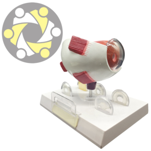 Mô Hình Giảng Dạy Của Mắt Đục Thủy Tinh Thể Bằng Nhựa Mở Rộng Sáu Lần - Product Image 5