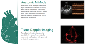 Nieuwe Sonoscape P50 P20 kleur doppler echografie machine met diagnostische 4D technologie - Product Image 5