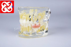 Mezcla de dentición modelo dental con los dientes permanentes y desdentado dientes de bebé y de retención - Product Image 5