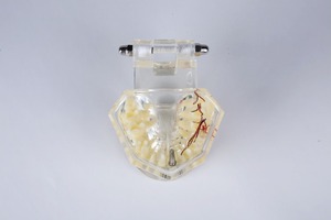 Nieuwe ontwerp Implant & restauratie tandheelkundige model met zenuw voor demonstreren endo training - Product Image 3