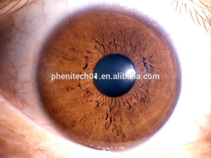 Best digital intelligent iriscope eye for iridology equipment - Product Image 6