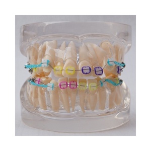 Dentale Ortodontico modello Con staffa di ceramica - Product Image 1
