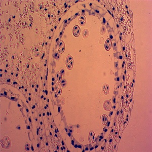 Hohe qualität reduktion mitose histologie vorbereitet folien set - Product Image 5