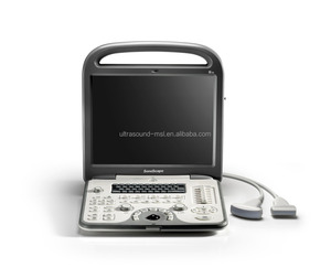 Appareil d'échographie Doppler couleur portable 3D 4D <span class=keywords><strong>Sonoscape</strong></span> <span class=keywords><strong>S6</strong></span> / Appareil d'échographie <span class=keywords><strong>Sonoscape</strong></span> de haute qualité - Product Image 4