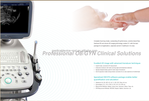 Échographe Doppler couleur Sonoscape S11 haute résolution - Product Image 4