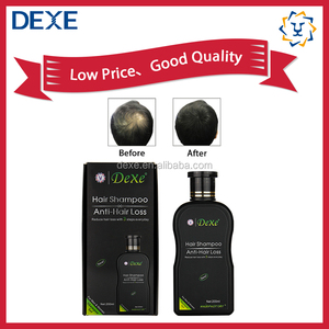 DEXE Shampoo al Ginseng di Lusso Unisex per Adulti, 200ml, per la Ricrescita dei <span class=keywords><strong>Capelli</strong></span> e Contro la <span class=keywords><strong>Caduta</strong></span>, per Uomini e Donne - Product Image 4