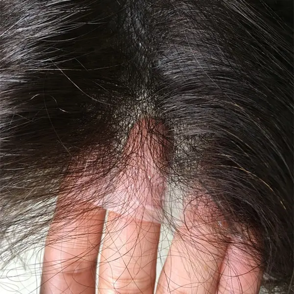La línea de cabello más natural para hombres, tupé de piel Superfina invisible, bucle en V en stock