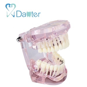 Modelo de ortodoncia de resina de la mejor calidad con soportes linguales para demostrar la posición <span class=keywords><strong>exacta</strong></span> de los cables de práctica - Product Image 4