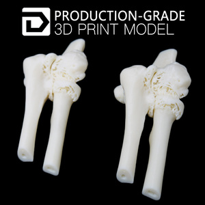 Bajo costo prótesis prototipo rápido <span class=keywords><strong>3D</strong></span> impresión personalizada implantes médicos - Product Image 2