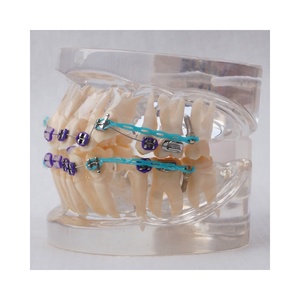 Dentale Ortodontico modello Con staffa di ceramica - Product Image 6