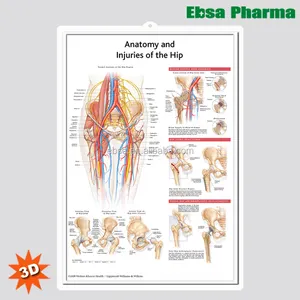 Cartazes de parede de anatomia humana 3d, cartazes de anatomia e lesões do quadril