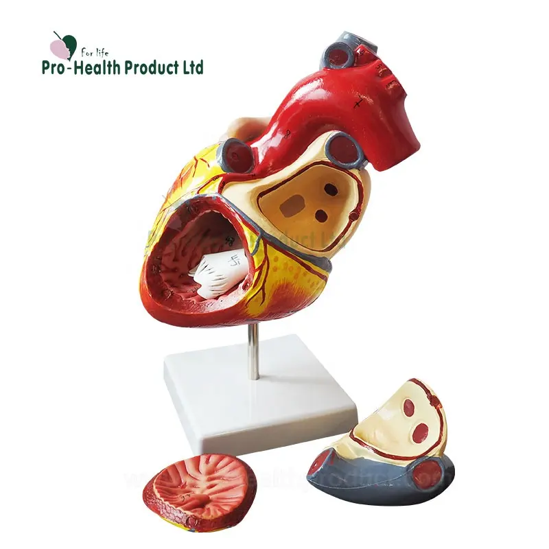 Double Size Amplification Human Heart In 4 Assemble Parts With Number Remark Anatomical Education Model