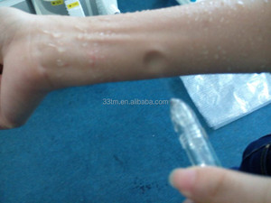 Fábrica <span class=keywords><strong>Merida</strong></span> Equipo De Oxígeno/Terapia de Oxígeno Máquina Facial - Product Image 2