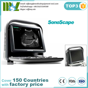 Mesin Ultrasound Merek Terkenal Hewan Sonoscape A5 dengan Harga Terbaik Di Cina