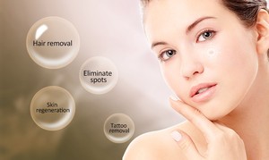 Mới nhất Salon Sử Dụng 4 Trong 1 Elight OPT <span class=keywords><strong>SHR</strong></span> Máy Tẩy Lông Bằng Laser - Product Image 5