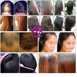 <span class=keywords><strong>Andrea</strong></span>-esencia auténtica para el crecimiento del cabello, ayuda a crecer el cabello, suero denso, 20ml/botella - Product Image 3