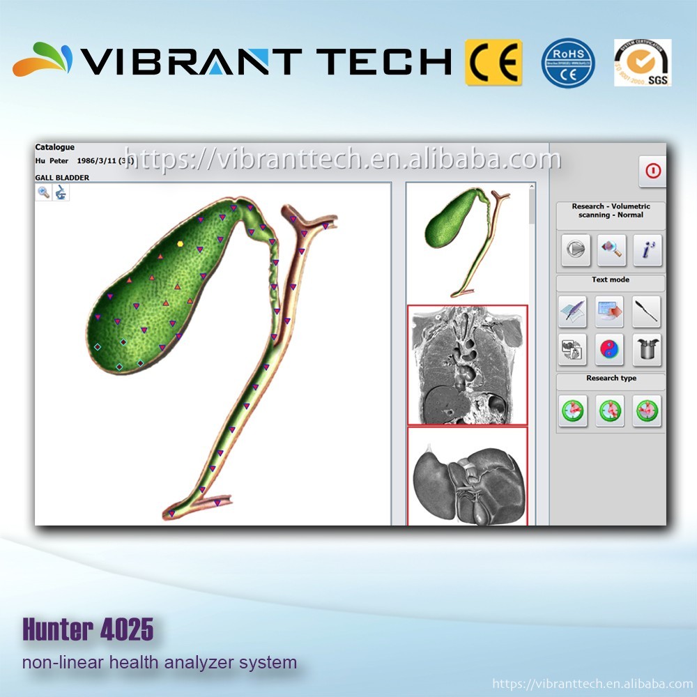Bioresonance Scan et Thérapie machine NLS Metatron Hunter 4025
