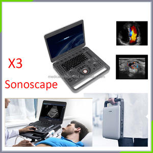 Distribuidor Exclusivo <span class=keywords><strong>de</strong></span> Ultrasonido X3 Sonoscape - Product Image 5