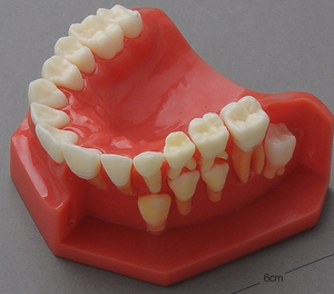 Modèle de développement pédiatrique à dentition mixte pour démonstration à l'âge de 9-12 ans - Product Image 3